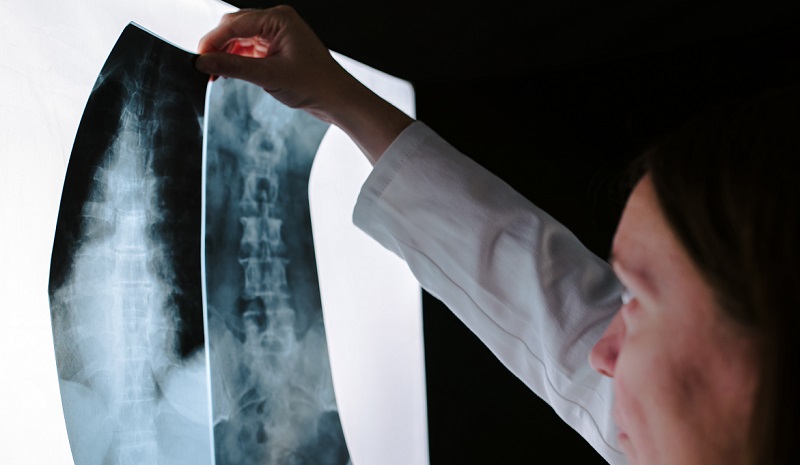 examining x-rays at a hospital